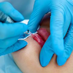 Micropigmentación Labial